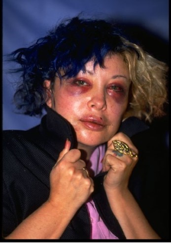 ORLAN, the carnal artist, in 1993