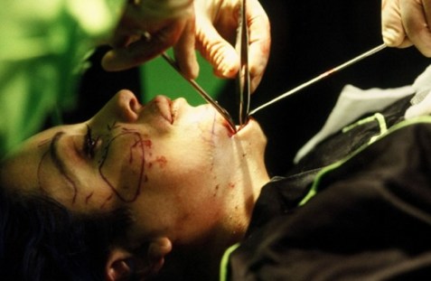 ORLAN, "The Second Mouth," 1993 ORLAN, "The Second Mouth," 1993